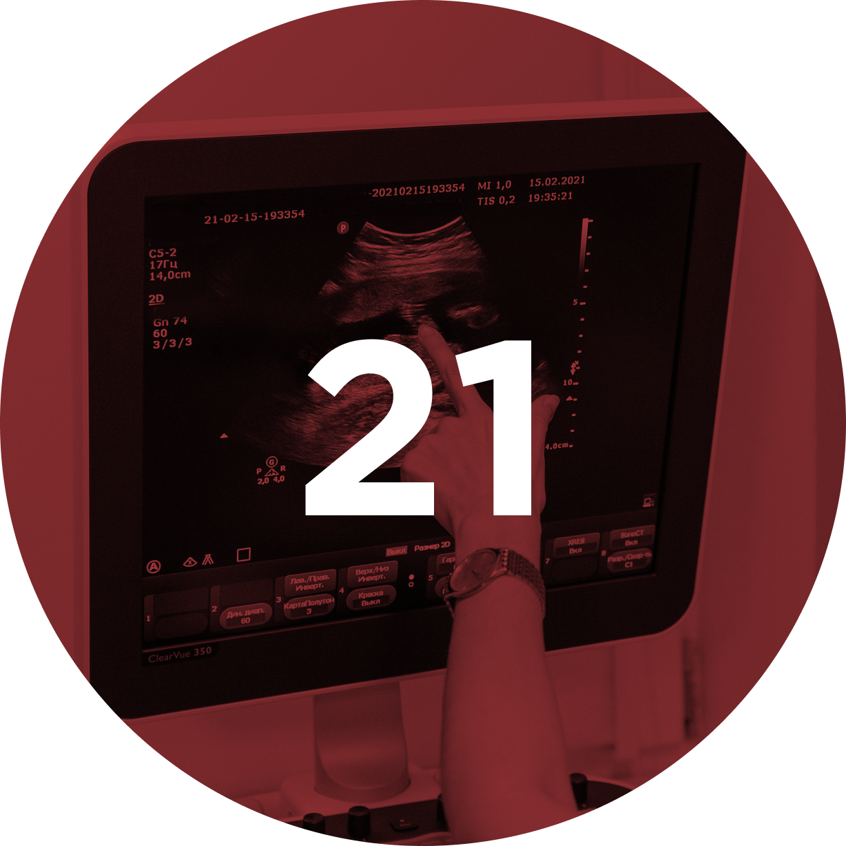 21